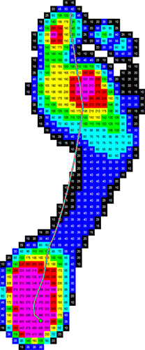 Plantar pressure map showing local sensor values and a gait line