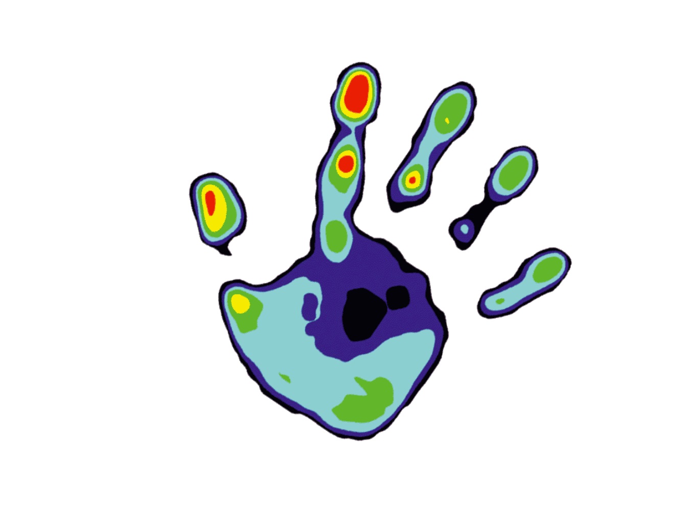 pressure mapping insole - pedar