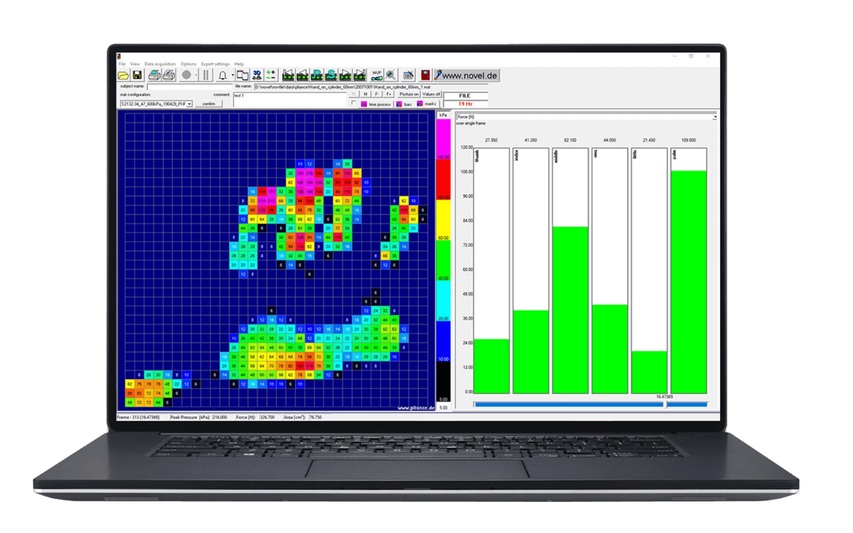 manugraphy hand assessment software