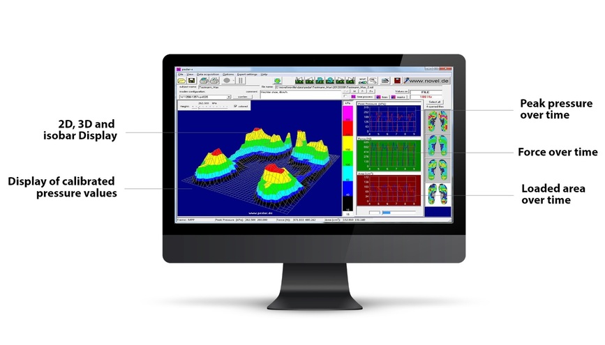 pressure mapping software - pedar - mobile pressure measurement under foot